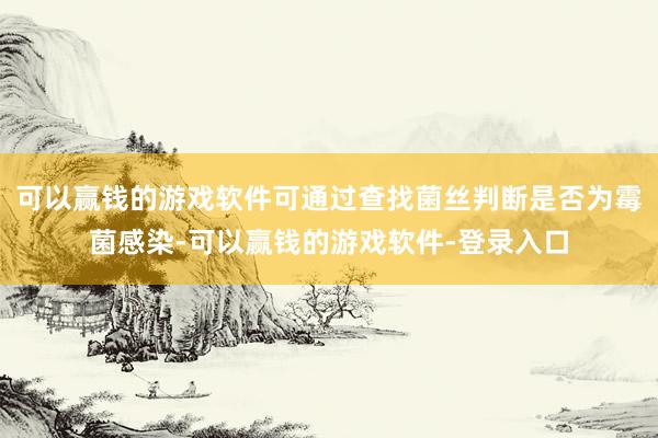可以赢钱的游戏软件可通过查找菌丝判断是否为霉菌感染-可以赢钱的游戏软件-登录入口